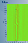20260309237354.png 案例3-3.png